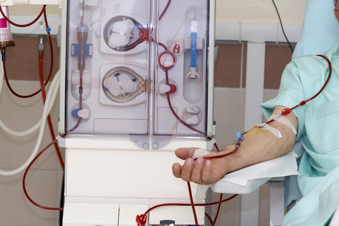 Glomerulonephritis Treatment